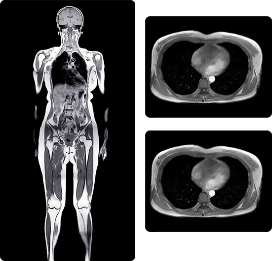 Full body MRI scan with cross-sectional chest images